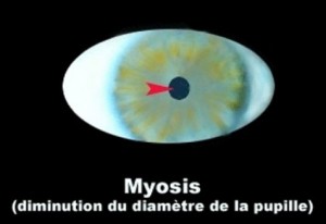 myosis