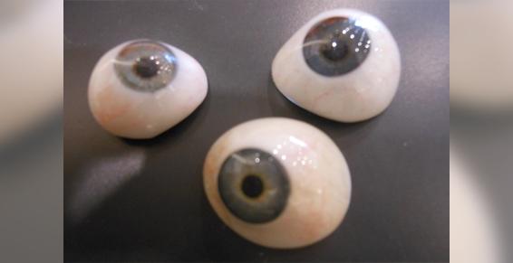 Le prothèse oculaire