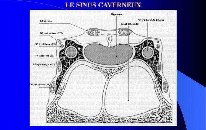 Sinus caverneux