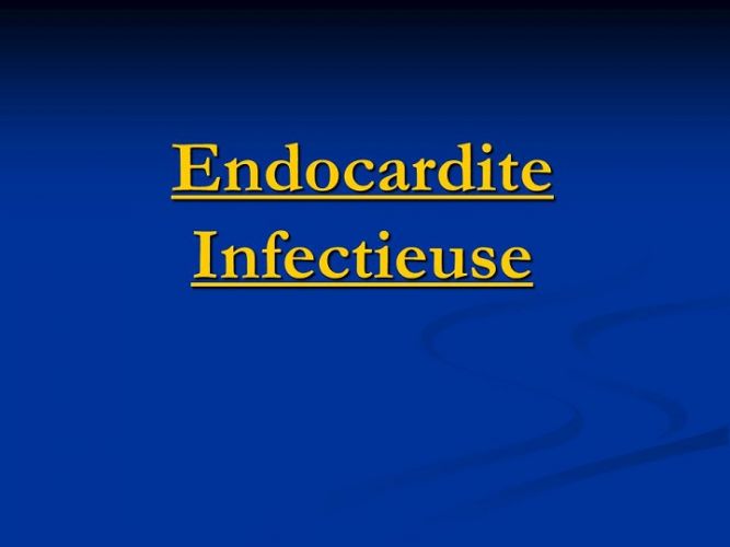 Endocardite infectieuse