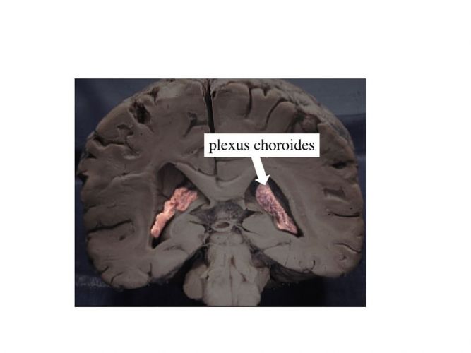 Plexus choroïdes